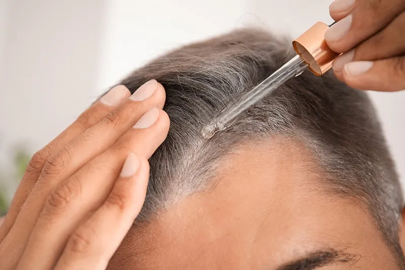 髪の成長を促進するヒト幹細胞の上清液