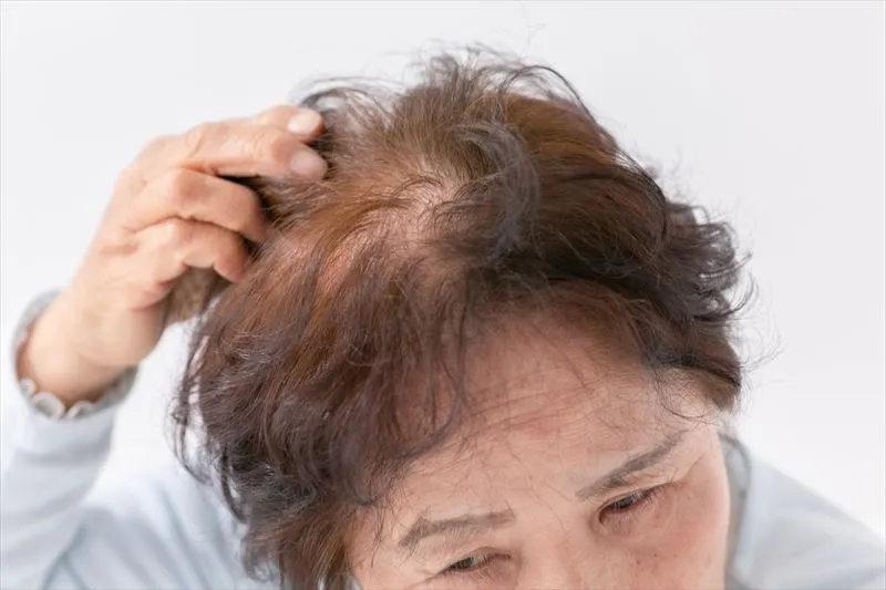 薄毛を改善するには